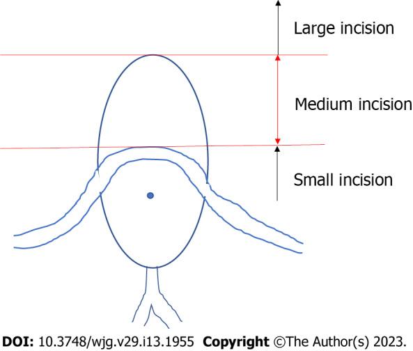https://cdn.ncbi.nlm.nih.gov/pmc/blobs/78ea/10122794/493d843ce310/WJG-29-1955-g001.jpg