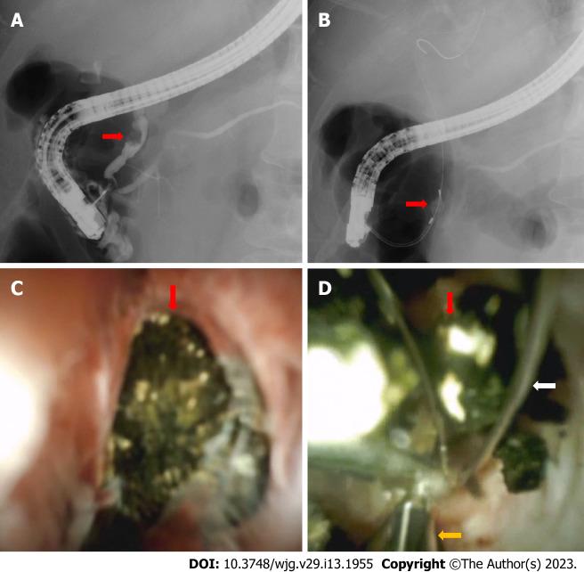 https://cdn.ncbi.nlm.nih.gov/pmc/blobs/78ea/10122794/e2f80c23e8f5/WJG-29-1955-g008.jpg