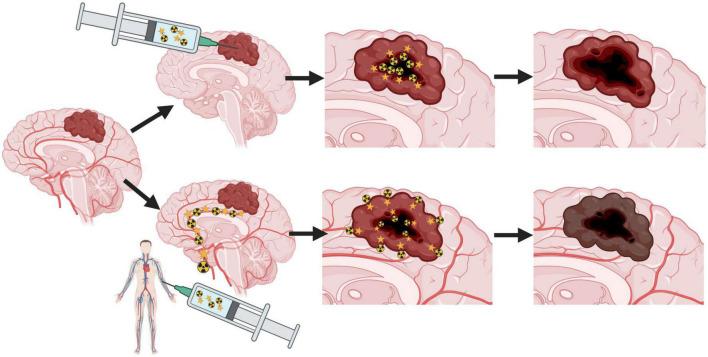 https://cdn.ncbi.nlm.nih.gov/pmc/blobs/78f6/9800503/d4a03ce6c97a/fmed-09-1085245-g001.jpg