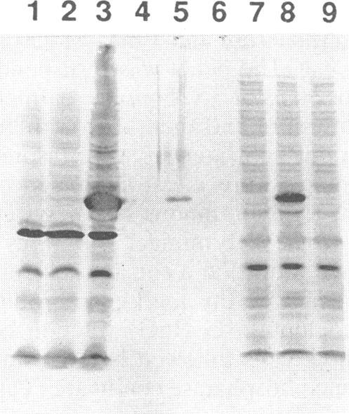 https://cdn.ncbi.nlm.nih.gov/pmc/blobs/78f7/186378/232141a3e7fa/iai00005-0162-a.jpg