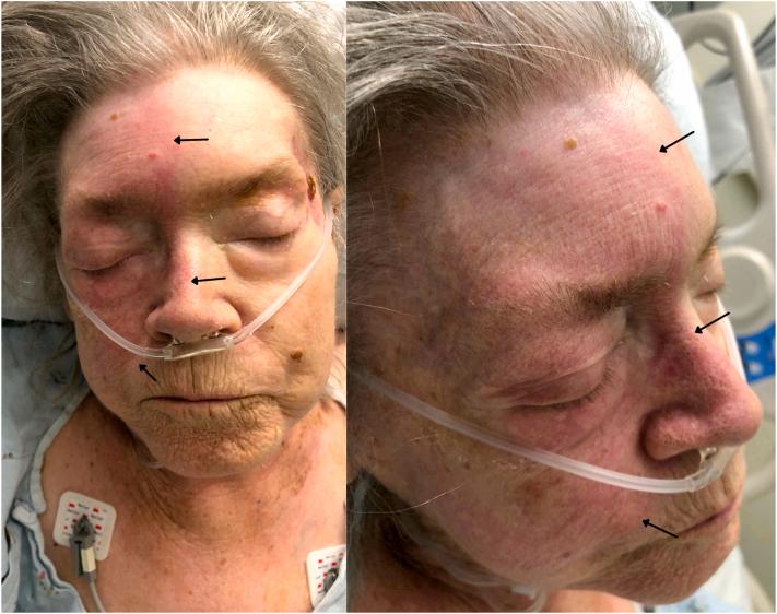 https://cdn.ncbi.nlm.nih.gov/pmc/blobs/78fa/10784641/376dc24b3ce5/gr1.jpg
