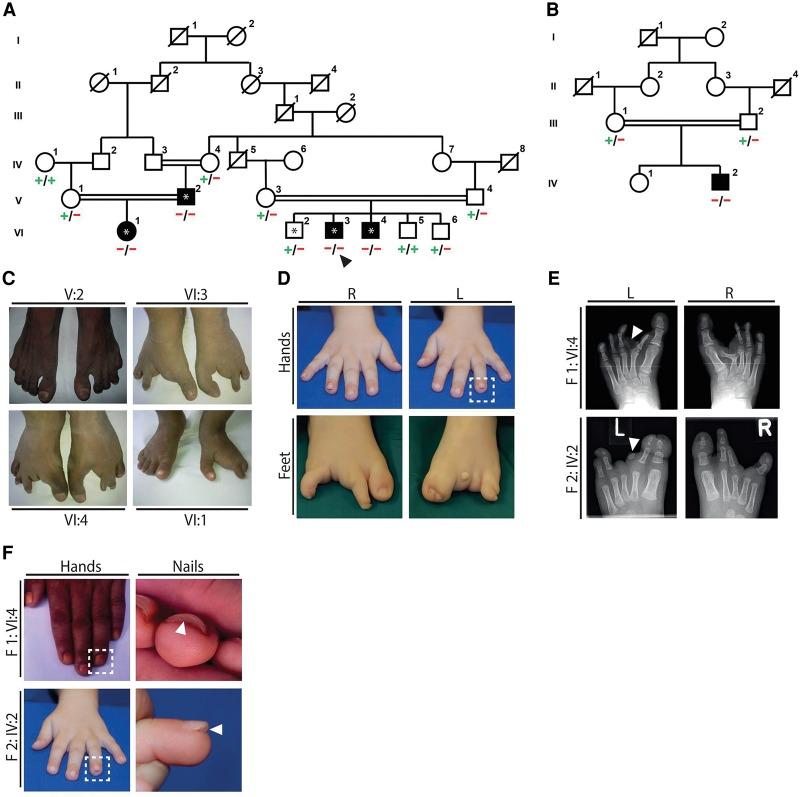 https://cdn.ncbi.nlm.nih.gov/pmc/blobs/78fa/4728371/465c3b918585/183f01.jpg