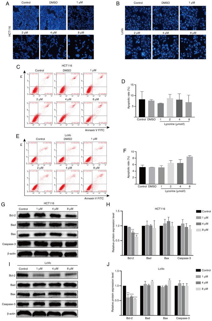 https://cdn.ncbi.nlm.nih.gov/pmc/blobs/78fb/7879421/e6d3b36e3267/or-45-04-7970-g03.jpg