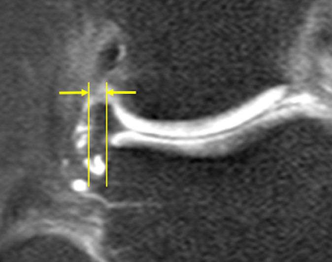 https://cdn.ncbi.nlm.nih.gov/pmc/blobs/78fb/9073126/d3fc7eb84e47/10.1177_23259671221091997-fig1.jpg