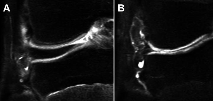 https://cdn.ncbi.nlm.nih.gov/pmc/blobs/78fb/9073126/d925d92b0004/10.1177_23259671221091997-fig2.jpg