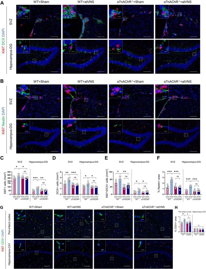 https://cdn.ncbi.nlm.nih.gov/pmc/blobs/7900/12082278/443140f5a948/CNS-31-e70439-g012.jpg