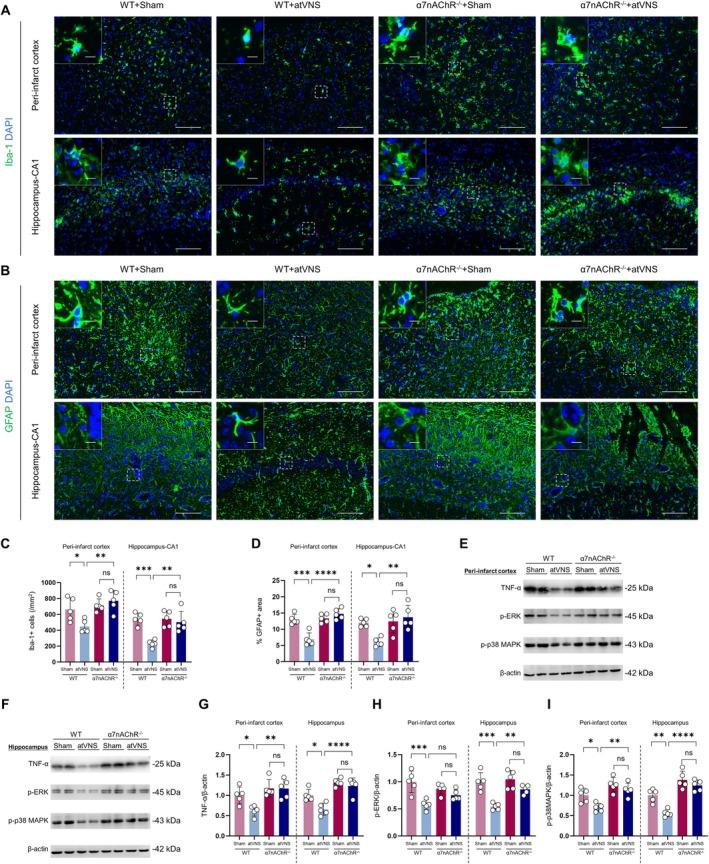 https://cdn.ncbi.nlm.nih.gov/pmc/blobs/7900/12082278/5d4d93684c16/CNS-31-e70439-g003.jpg