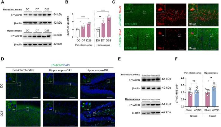 https://cdn.ncbi.nlm.nih.gov/pmc/blobs/7900/12082278/b016e4025560/CNS-31-e70439-g005.jpg