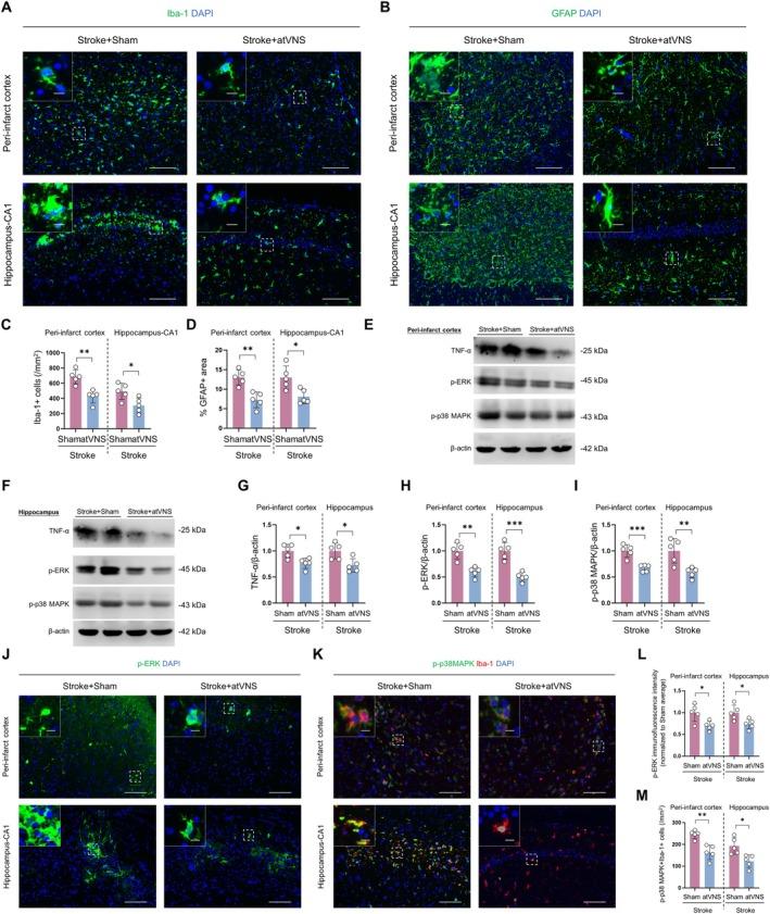 https://cdn.ncbi.nlm.nih.gov/pmc/blobs/7900/12082278/d107c53138c3/CNS-31-e70439-g002.jpg