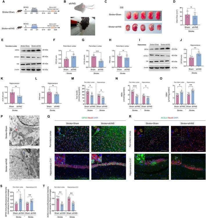 https://cdn.ncbi.nlm.nih.gov/pmc/blobs/7900/12082278/fefabb4a9cbd/CNS-31-e70439-g006.jpg