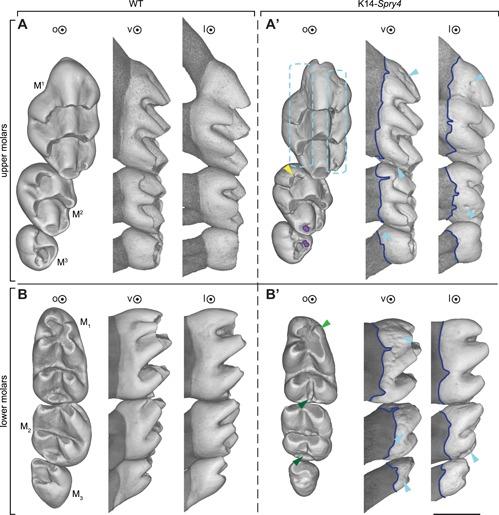 https://cdn.ncbi.nlm.nih.gov/pmc/blobs/7914/6715786/c5d12e0572e6/JBM4-3-na-g001.jpg
