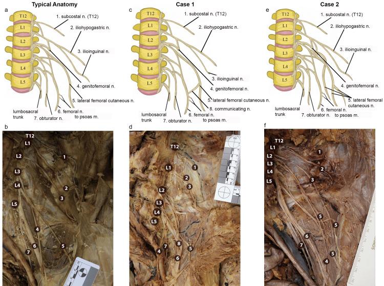 https://cdn.ncbi.nlm.nih.gov/pmc/blobs/7916/12407572/b45077f936cd/cureus-0017-00000089354-i01.jpg