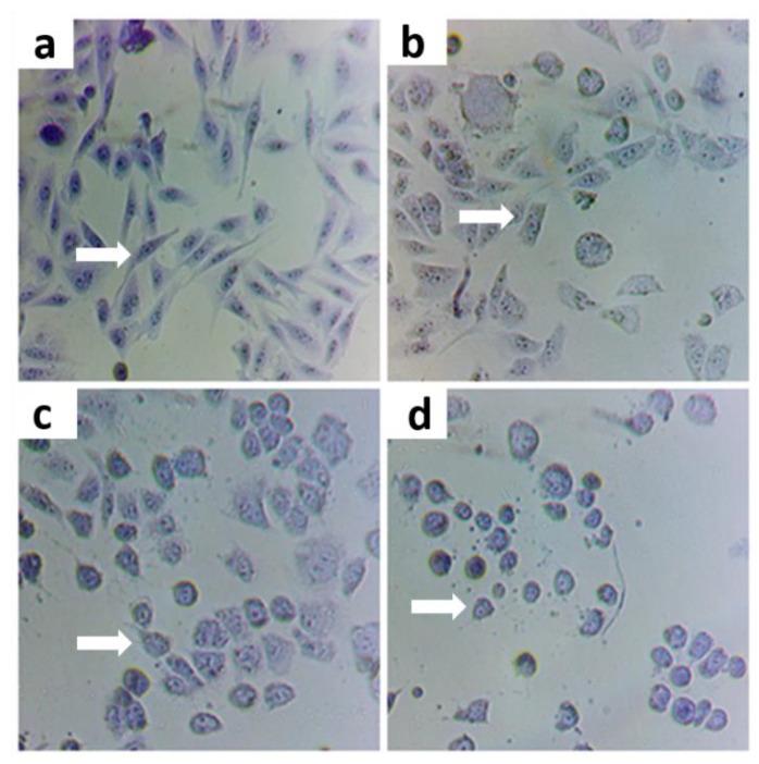 https://cdn.ncbi.nlm.nih.gov/pmc/blobs/791b/9412518/05c70ce9a712/nutrients-14-03265-g001.jpg