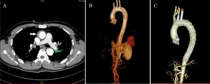 https://cdn.ncbi.nlm.nih.gov/pmc/blobs/791d/10091647/3300a338064b/13019_2023_2234_Fig1_HTML.jpg