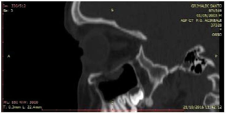https://cdn.ncbi.nlm.nih.gov/pmc/blobs/791d/5712659/286768465768/TODENTJ-11-546_F3.jpg