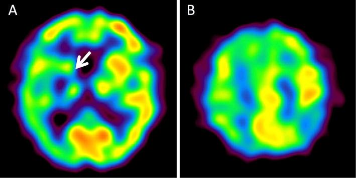 https://cdn.ncbi.nlm.nih.gov/pmc/blobs/791f/8710370/819f7d1c3874/1349-7235-60-3805-g002.jpg