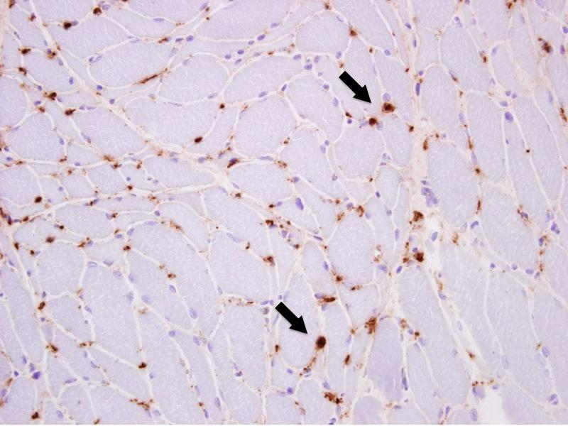 https://cdn.ncbi.nlm.nih.gov/pmc/blobs/7929/6485526/46984252868d/cureus-0011-00000004139-i08.jpg