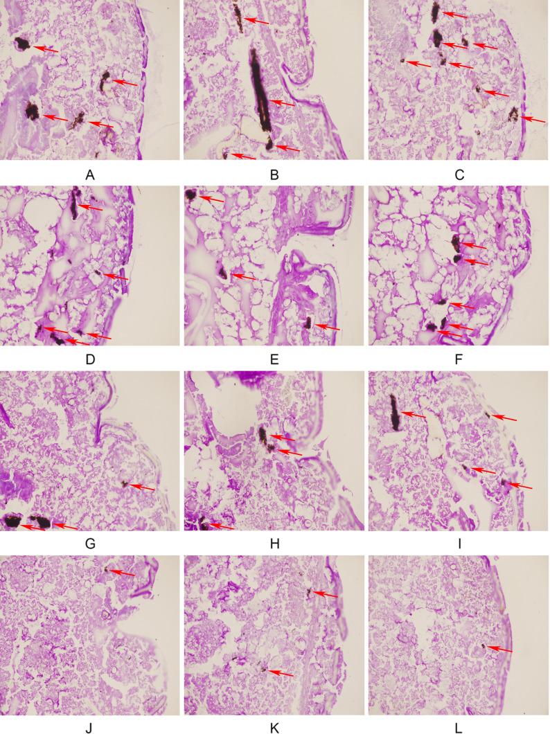 https://cdn.ncbi.nlm.nih.gov/pmc/blobs/792c/11897512/a08697904c72/fcimb-15-1455123-g002.jpg