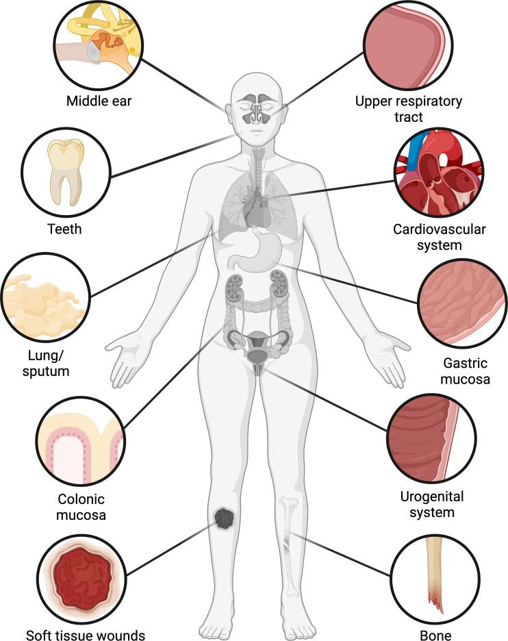 https://cdn.ncbi.nlm.nih.gov/pmc/blobs/792d/10499362/1343c7d18285/fcimb-13-1237164-g001.jpg