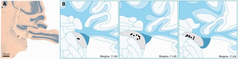 https://cdn.ncbi.nlm.nih.gov/pmc/blobs/7933/6419256/2af3246b8ecd/10.1177_2331216519835080-fig2.jpg