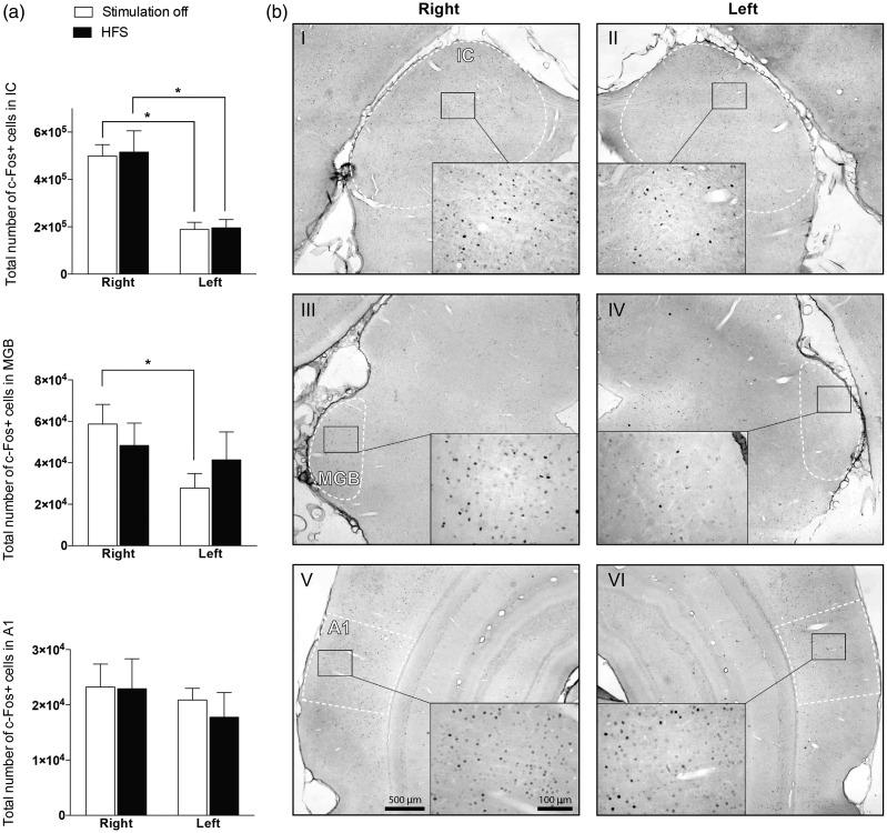 https://cdn.ncbi.nlm.nih.gov/pmc/blobs/7933/6419256/3e28e4eb8877/10.1177_2331216519835080-fig5.jpg