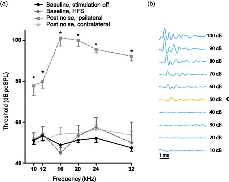 https://cdn.ncbi.nlm.nih.gov/pmc/blobs/7933/6419256/46d27420d4d2/10.1177_2331216519835080-fig4.jpg