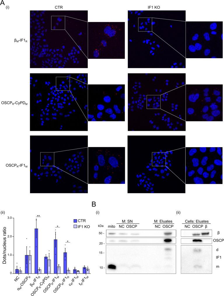 https://cdn.ncbi.nlm.nih.gov/pmc/blobs/793b/9870916/f92d69d71763/41419_2023_5572_Fig2_HTML.jpg