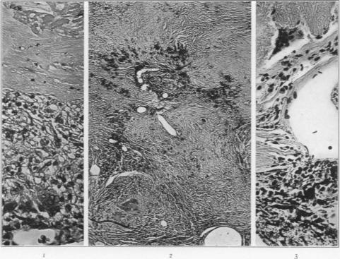 https://cdn.ncbi.nlm.nih.gov/pmc/blobs/793f/2062763/37e7c64d1cb5/amjpathol00718-0074-a.jpg