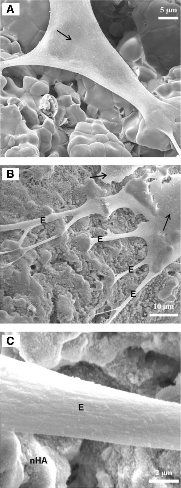 https://cdn.ncbi.nlm.nih.gov/pmc/blobs/7941/3994218/537f9d0851f7/1471-2474-15-114-3.jpg