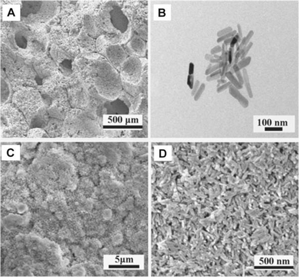 https://cdn.ncbi.nlm.nih.gov/pmc/blobs/7941/3994218/c47993f01fcf/1471-2474-15-114-1.jpg