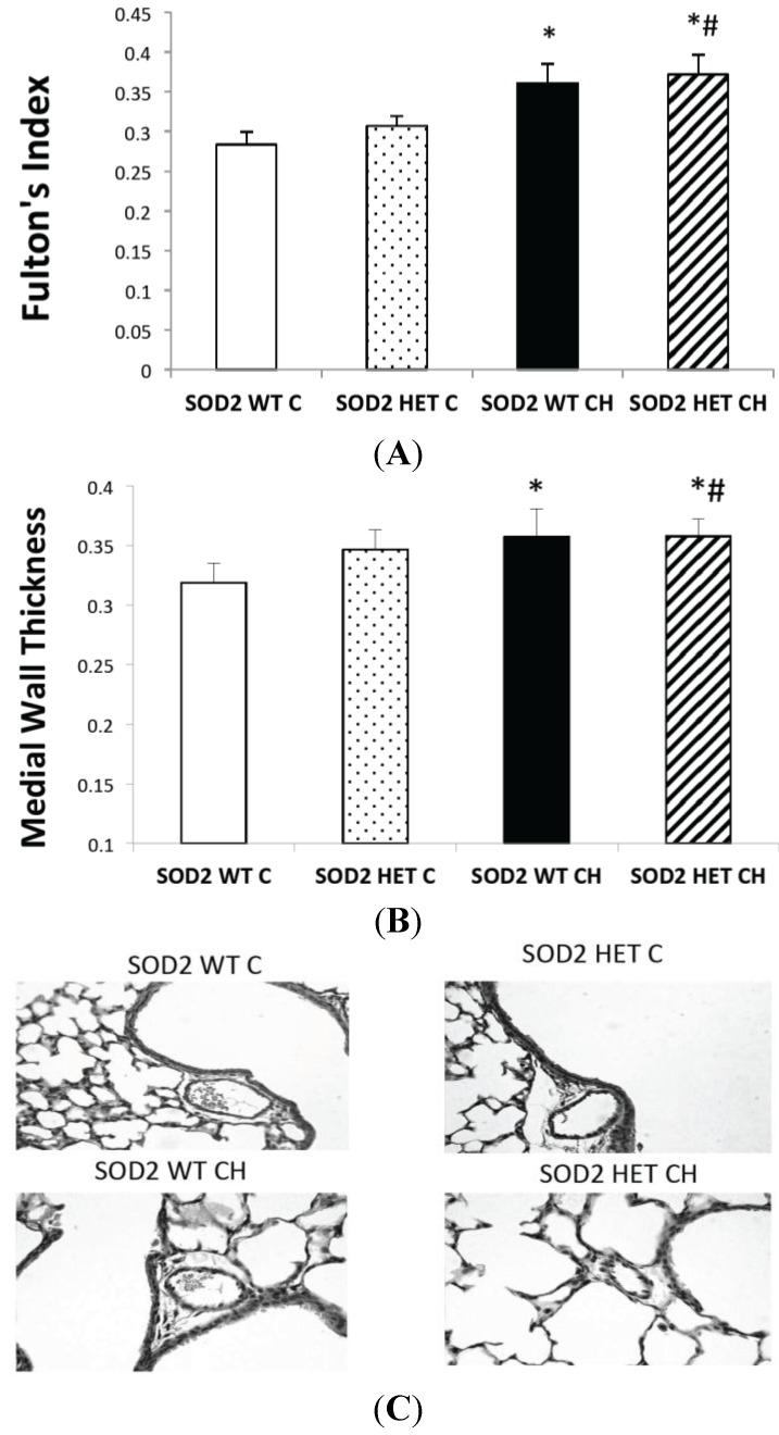 https://cdn.ncbi.nlm.nih.gov/pmc/blobs/7945/4394537/c2e97554f0b5/ijms-16-06373-g005.jpg