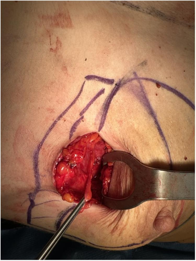 https://cdn.ncbi.nlm.nih.gov/pmc/blobs/794d/12123325/17491fedad48/gr4.jpg