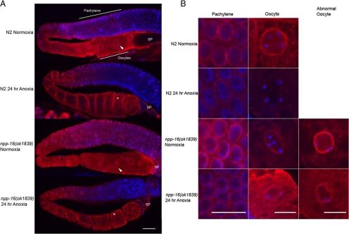 https://cdn.ncbi.nlm.nih.gov/pmc/blobs/7958/2828959/f93a6a6951df/zmk0051093600007.jpg