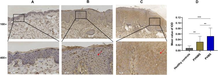 https://cdn.ncbi.nlm.nih.gov/pmc/blobs/795a/10460594/195e886d8fda/CCID-16-2297-g0003.jpg