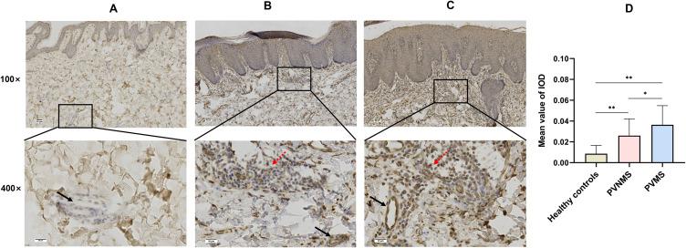 https://cdn.ncbi.nlm.nih.gov/pmc/blobs/795a/10460594/1e140df88b34/CCID-16-2297-g0002.jpg