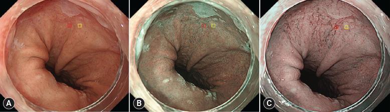 https://cdn.ncbi.nlm.nih.gov/pmc/blobs/795a/12001031/34d04d6b9969/ce-2024-122f2.jpg