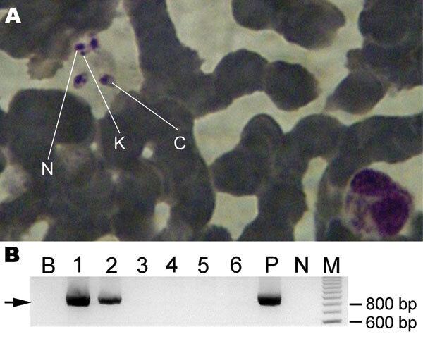 https://cdn.ncbi.nlm.nih.gov/pmc/blobs/795a/3310450/f867e630975e/11-0924-F1.jpg