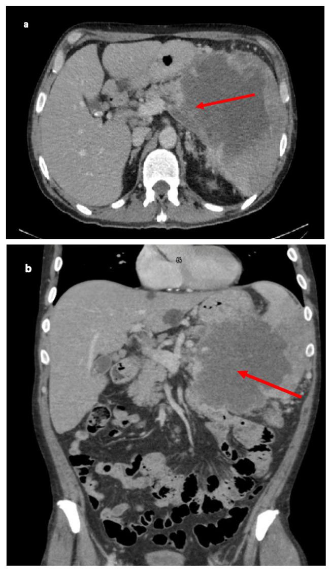 https://cdn.ncbi.nlm.nih.gov/pmc/blobs/795d/9529642/21a652e1f577/jchim-12-05-060f1.jpg
