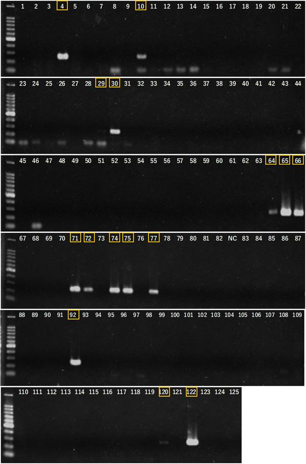 https://cdn.ncbi.nlm.nih.gov/pmc/blobs/7961/12319568/fc9e0daedd5f/VMS3-11-e70491-g001.jpg