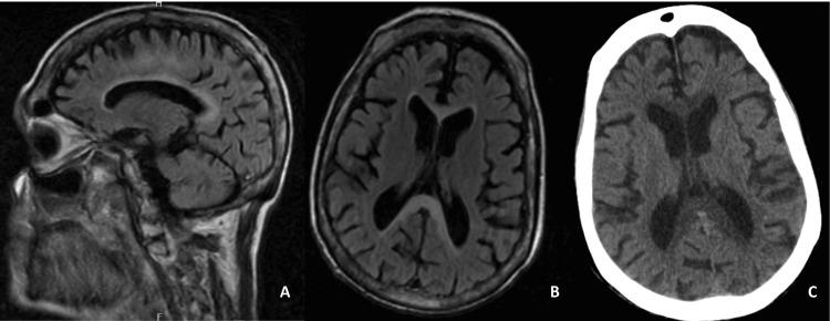 https://cdn.ncbi.nlm.nih.gov/pmc/blobs/7966/11704978/801da58a7fc0/cureus-0016-00000075308-i01.jpg