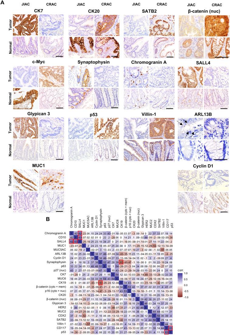 https://cdn.ncbi.nlm.nih.gov/pmc/blobs/7966/12148733/b8c441637571/gr1.jpg