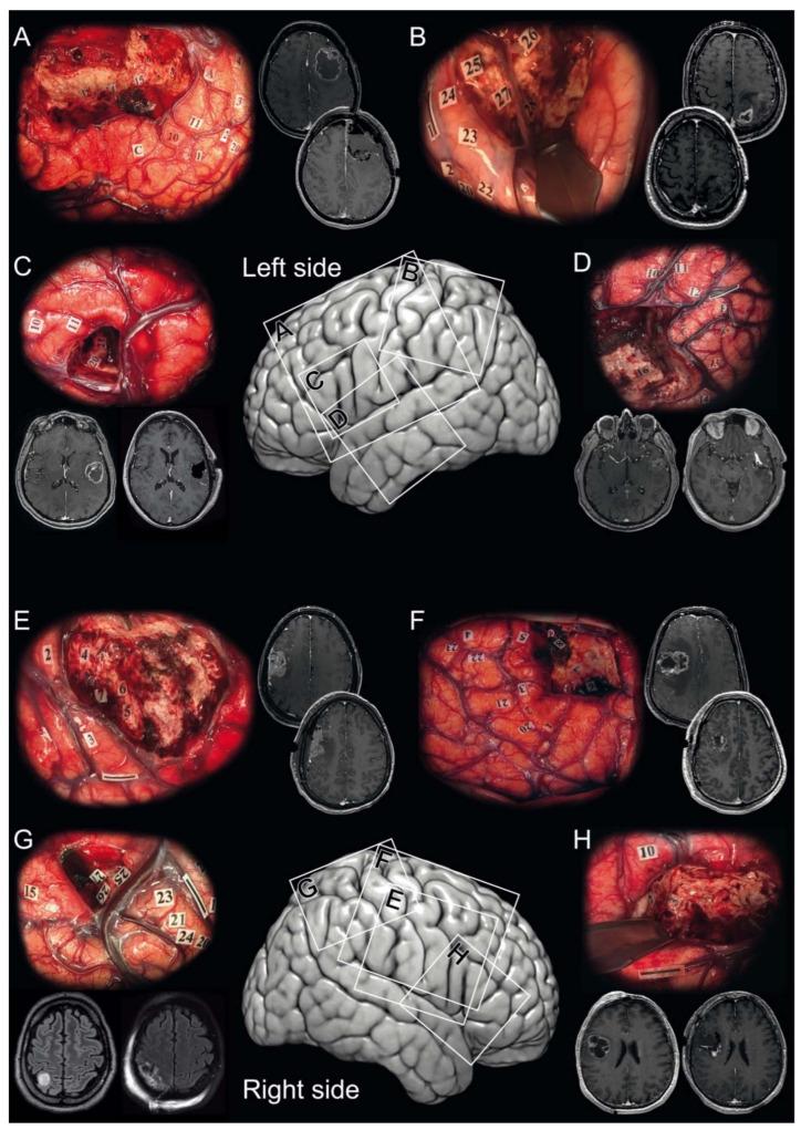 https://cdn.ncbi.nlm.nih.gov/pmc/blobs/7967/8230499/d4dcc6bf6340/cancers-13-02911-g001.jpg