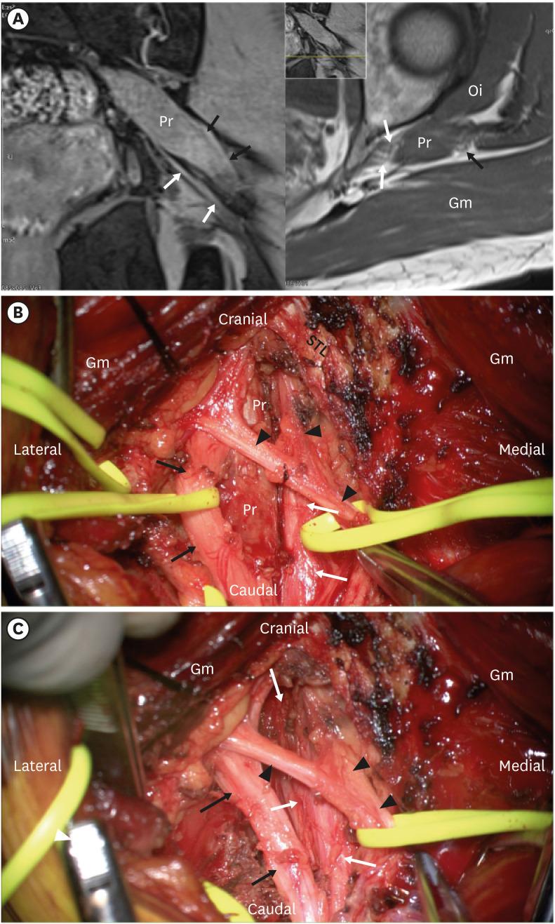https://cdn.ncbi.nlm.nih.gov/pmc/blobs/7969/9634287/d98d86bd21e2/kjn-18-434-g002.jpg