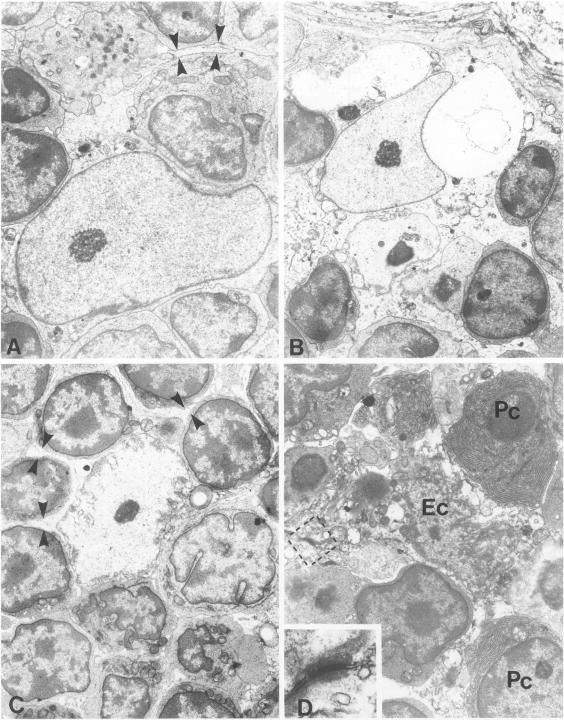 https://cdn.ncbi.nlm.nih.gov/pmc/blobs/796d/1887226/8de244f1f6a7/amjpathol00069-0066-a.jpg