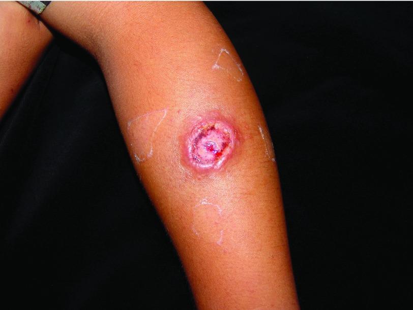 https://cdn.ncbi.nlm.nih.gov/pmc/blobs/796f/5464238/16a97b5d3198/f1000research-6-11996-g0002.jpg