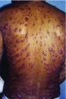 https://cdn.ncbi.nlm.nih.gov/pmc/blobs/796f/5464238/48d7228df3c3/f1000research-6-11996-g0006.jpg