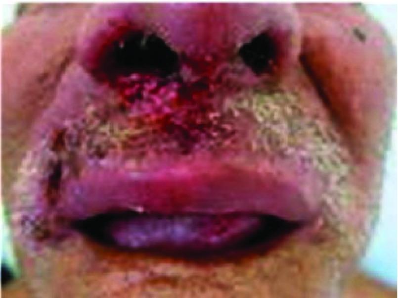 https://cdn.ncbi.nlm.nih.gov/pmc/blobs/796f/5464238/7f8269972e66/f1000research-6-11996-g0007.jpg