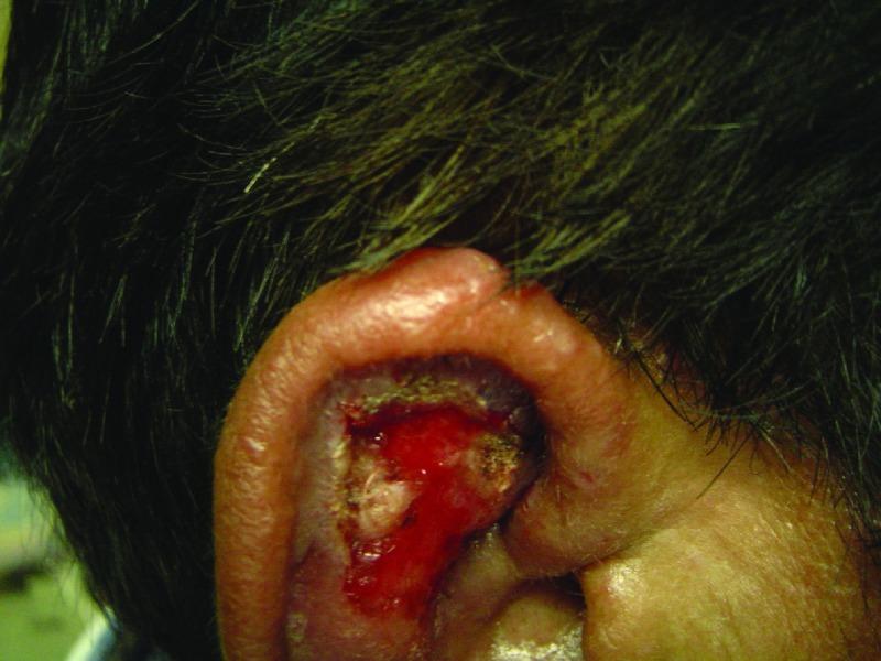 https://cdn.ncbi.nlm.nih.gov/pmc/blobs/796f/5464238/8b9c8b17ee7c/f1000research-6-11996-g0004.jpg