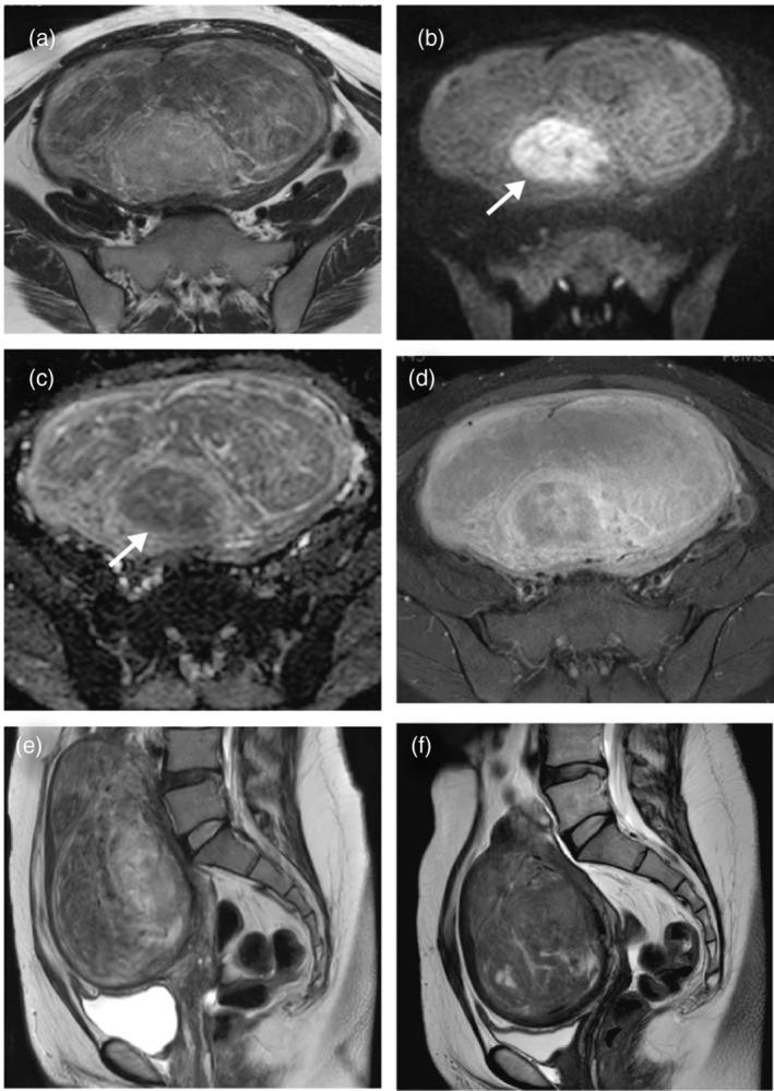 https://cdn.ncbi.nlm.nih.gov/pmc/blobs/7971/12058349/5bc71ee3f1ea/JOG-51-0-g001.jpg