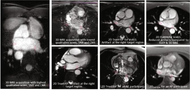 https://cdn.ncbi.nlm.nih.gov/pmc/blobs/7973/9448688/b296b45f26a2/13246_2022_1141_Fig3_HTML.jpg